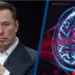 Elon Musk Neuralink Chip