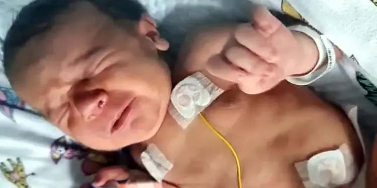 UAE में पांच महीने के शिशु की सबसे कम उम्र में लीवर ट्रांसप्लांट, चाची ने बचाई जान